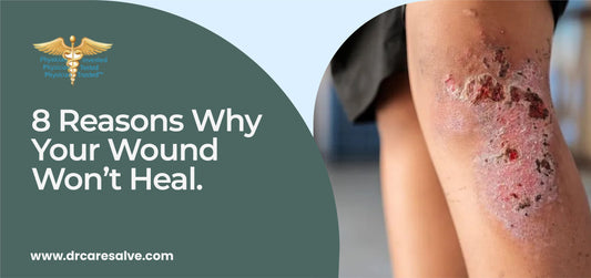 8 Reasons Why Your Wound Won’t Heal